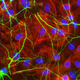 Neutrophils (shown in blue) are immune cells that help to heal the brain.